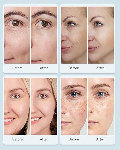 Clarity Canvas 7-Colour LED Face Mask